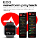Montre Connectée De Santé Avec Écran 2 Pouces ECG Appels Bluetooth Suivi Cardiaque Autonomie De 4 À 6 Jours Android IOS - www...